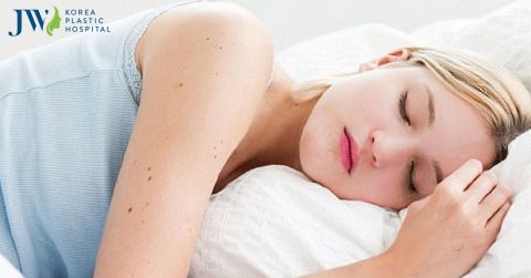 Nâng mũi bao lâu thì được nằm nghiêng? Tư thế ngủ đúng như thế nào?