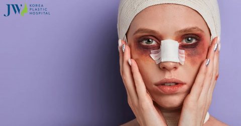 Nâng mũi bị bầm mắt có sao không? Nguyên nhân và cách xử lí