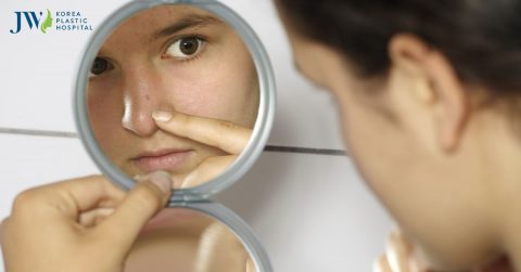Nâng mũi bị nổi mụn là chuyện bình thường hay bất thường?