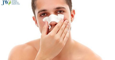 Nâng mũi nam giới giá bao nhiêu tiền?