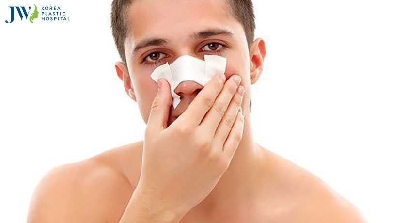 Nâng mũi nam giới giá bao nhiêu tiền?