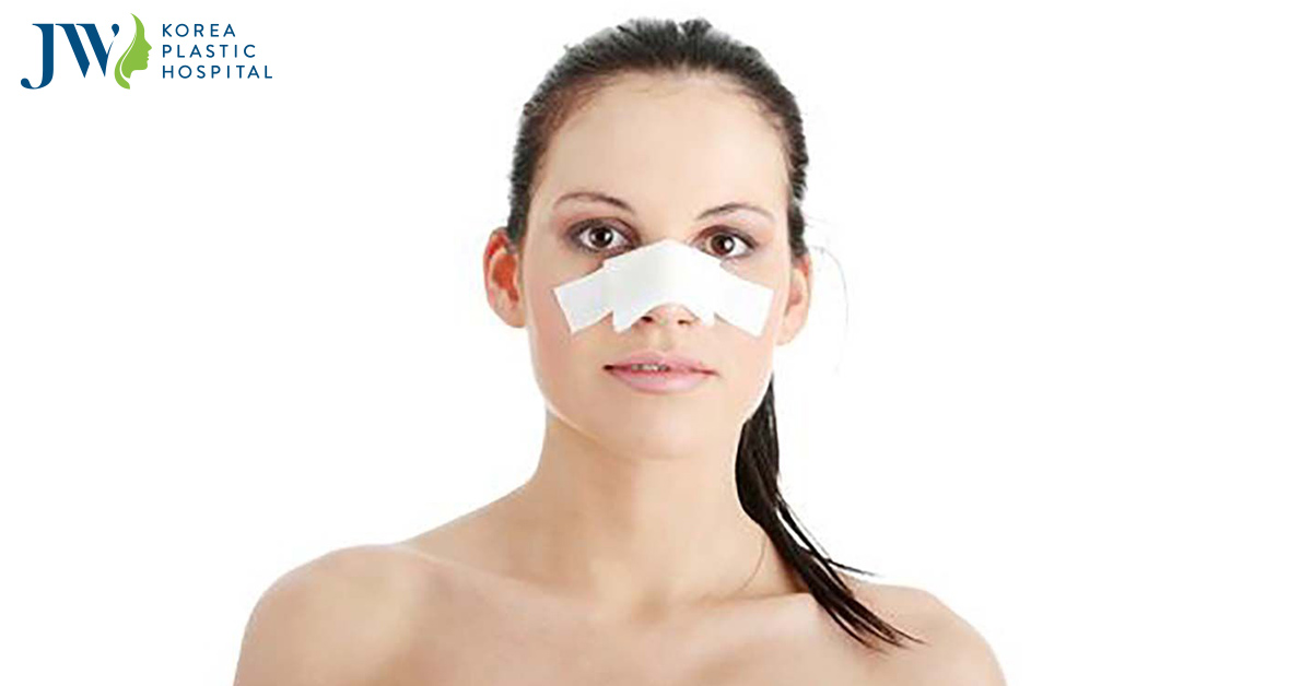 Nâng mũi mấy ngày tháo nẹp? Có nên tự tháo nẹp ở nhà không?