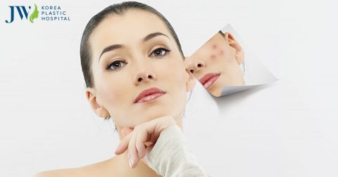 Bật mí cách trị mụn đơn giản tại nhà hiệu quả bất ngờ