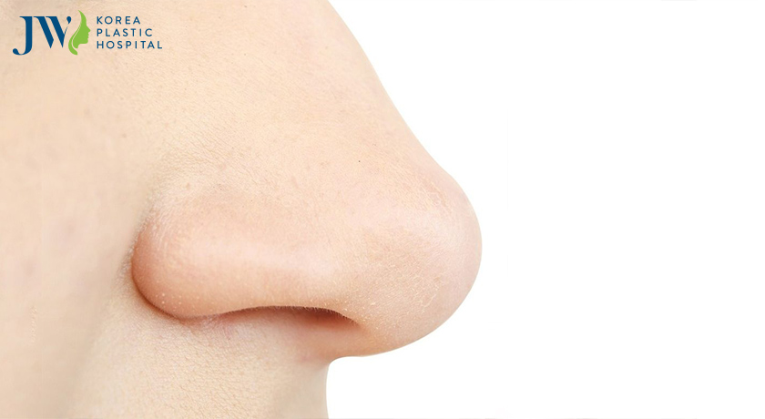 Thu gọn cánh mũi có để lại sẹo không thu hút nhiều sự quan tâm ?