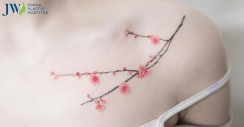Cách xóa xăm tại nhà an toàn không để lại sẹo trên da