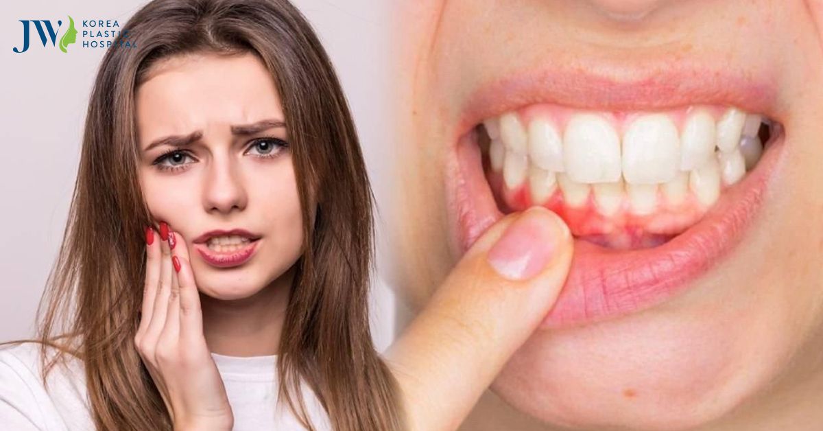 Sự thật ít người biết về tác dụng làm trắng răng của kem đánh răng