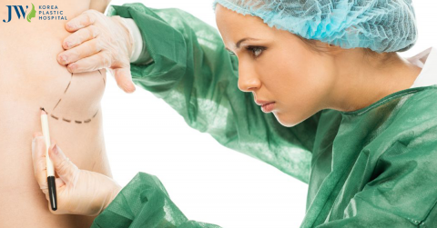 Nâng ngực đường chân ngực là gì? Thích hợp cho những đối tượng nào?
