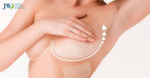 Nâng ngực có bị mất cảm giác không? Cần làm gì để vết mổ ngực mau lành?