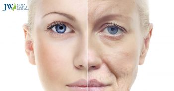 Cải lão gương mặt 3M có thể cùng một lúc áp dụng 3 dịch vụ không?