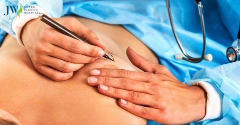 Nâng ngực bị hỏng, lệch, bao xơ nguy hiểm đến tính mạng