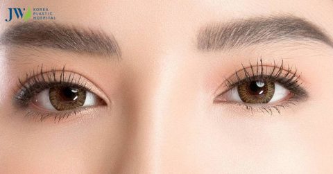 Lấy mỡ bọng mắt ở đâu tốt, hiệu quả an toàn dài lâu