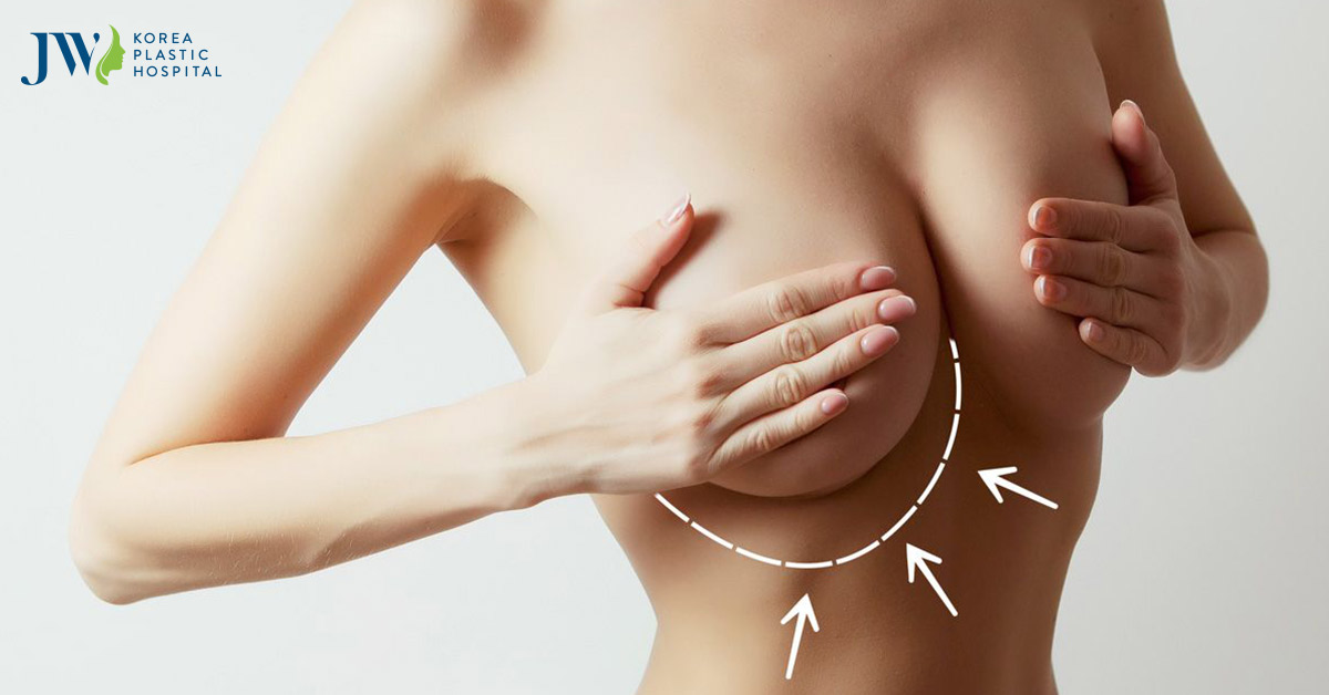Phẫu thuật nâng ngực có đau không? Làm sao để ngực mau hồi phục?