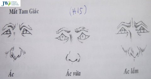 Mắt tam giác là gì mà người ta đánh giá là thiếu thiện cảm