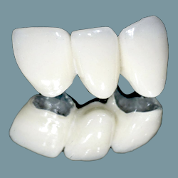 Răng sứ kim loại Ni-Cr