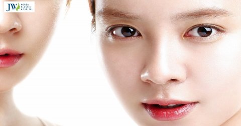 Quy trình bấm mí sau 60 phút có ngay đôi mắt búp bê tại Bệnh viện JW