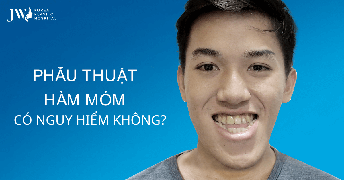Phẫu thuật hàm móm có nguy hiểm không? Chuyên gia giải đáp