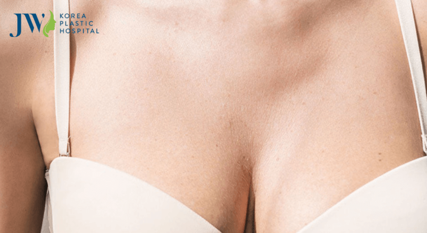 quy trình nâng ngực an toàn 