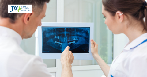 Có nên phẫu thuật hàm móm? Phẫu thuật hàm móm có phức tạp không?