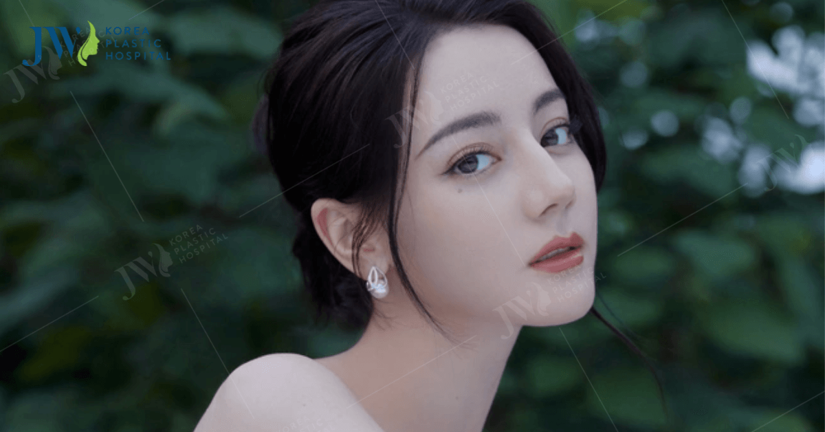 Chi phí chỉnh hàm lệch