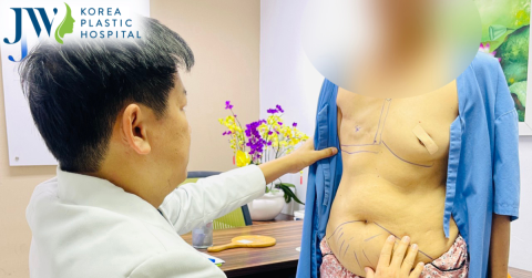 Tái tạo thành công vòng 1 cho bệnh nhân ung thư vú