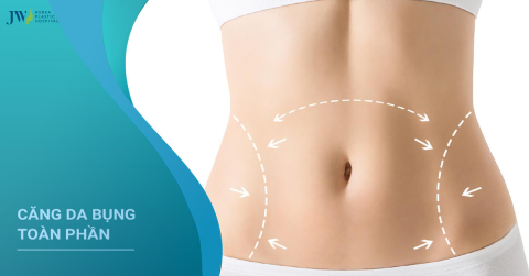 Căng da bụng: Quy trình chăm sóc và thực hiện phẫu thuật
