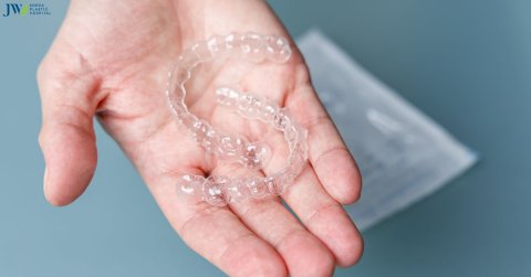 Bạn đã sử dụng niềng răng trong suốt AI đúng cách chưa?