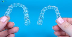 Niềng răng trong suốt AI có điều trị răng hô hàm trên được không? thumb