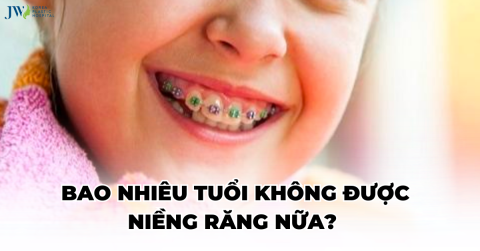 [ Giải đáp ] Bao nhiêu tuổi không được niềng răng nữa?