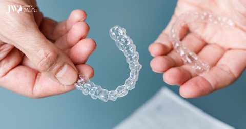 Chi phí niềng răng trong suốt AI: Liệu có đắt hơn mắc cài