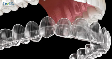 Niềng răng trong suốt AI: Có ăn được không?