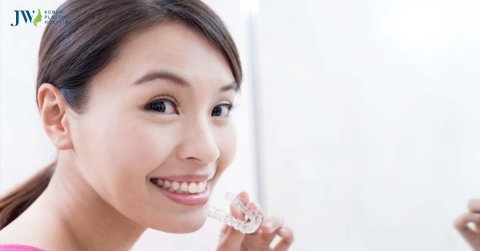 Niềng răng trong suốt AI tiếng Anh được hiểu là gì?