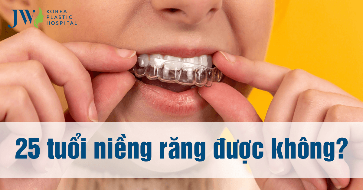 25 TUỔI CÓ NIỀNG RĂNG ĐƯỢC KHÔNG?