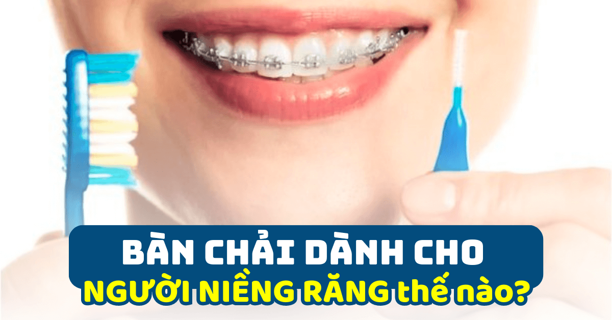 Bàn chải cho niềng răng tốt nhất hiện nay như thế nào?