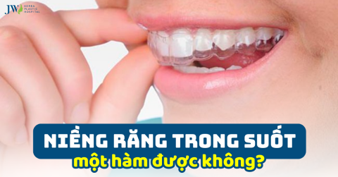[GIẢI ĐÁP THẮC MẮC] Niềng Răng Trong Suốt 1 Hàm Được Không?
