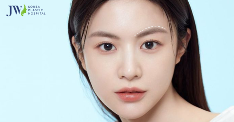 Treo chân mày – Trẻ hóa đôi mắt toàn diện chỉ sau 45 phút