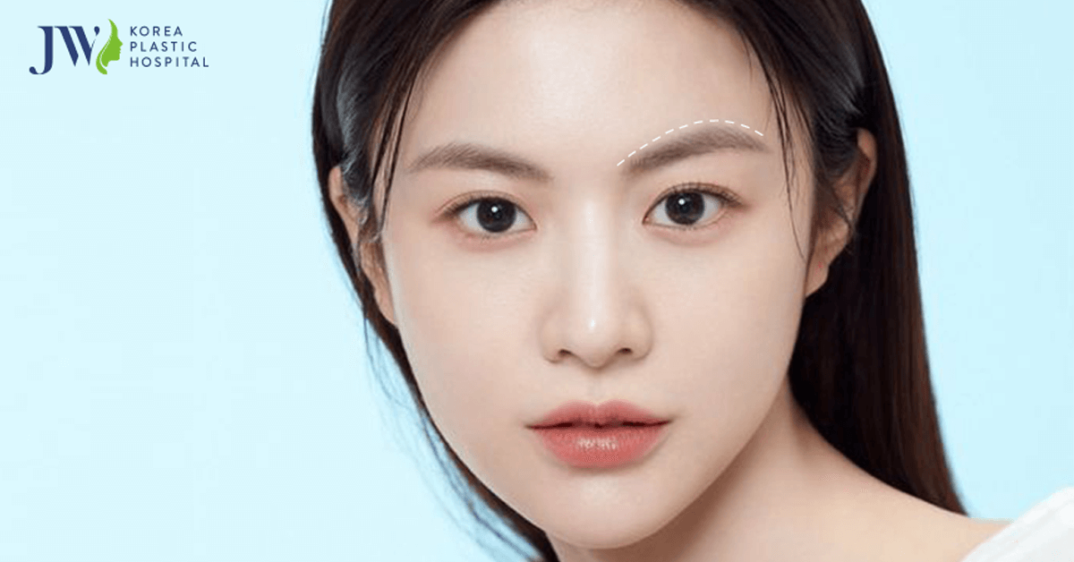 Treo chân mày – Trẻ hóa đôi mắt toàn diện chỉ sau 45 phút