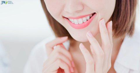 Đừng bỏ lỡ: Phương pháp giúp ngăn chặn việc răng chạy lại sau khi niềng!