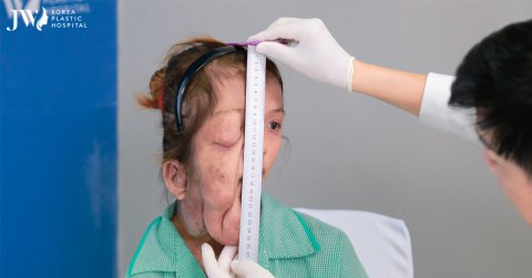 Tìm lại “gương mặt xinh đẹp” cho cô bé 25 tuổi nhưng nặng chỉ 37kg