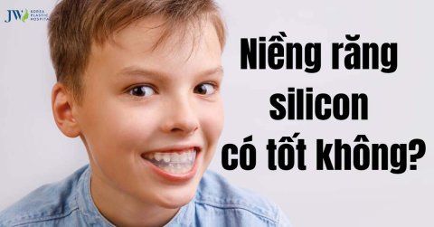 Niềng răng silicon có hiệu quả không? Một số lưu ý nên biết
