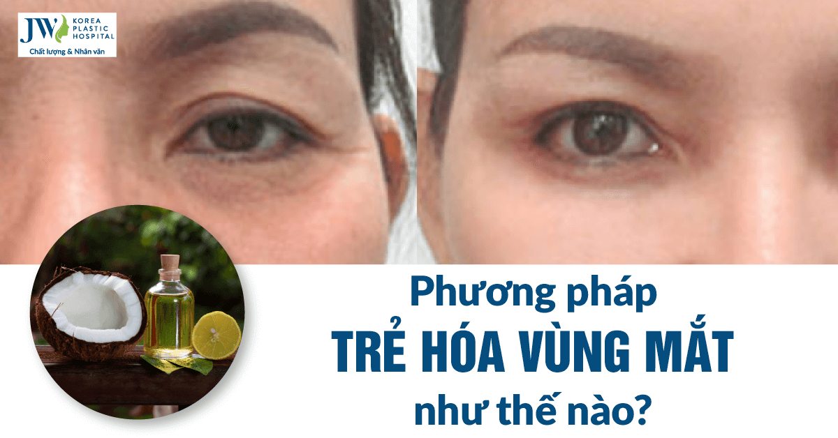 Trẻ hóa vùng mắt: Bạn hiểu như thế nào về phương pháp này?