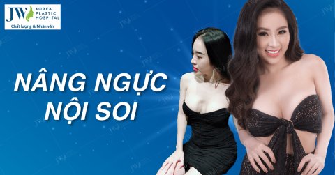 Top những ca nâng ngực nội soi khủng nhất tại Bệnh viện JW