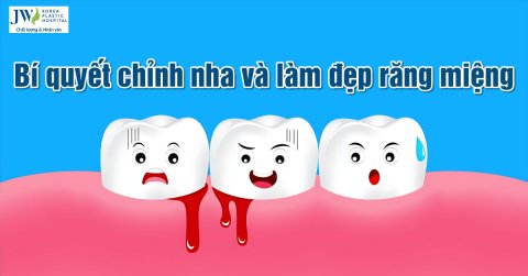 Bí quyết chỉnh nha và làm đẹp răng miệng dịp cuối năm
