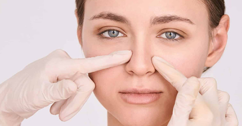 Nâng mũi bị hỏng biến dạng – Nỗi lo sợ kinh hoàng khi làm đẹp