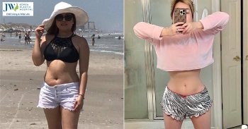 Combo Nâng ngực và Hút mỡ bụng giúp U50 Việt kiều tự tin hơn