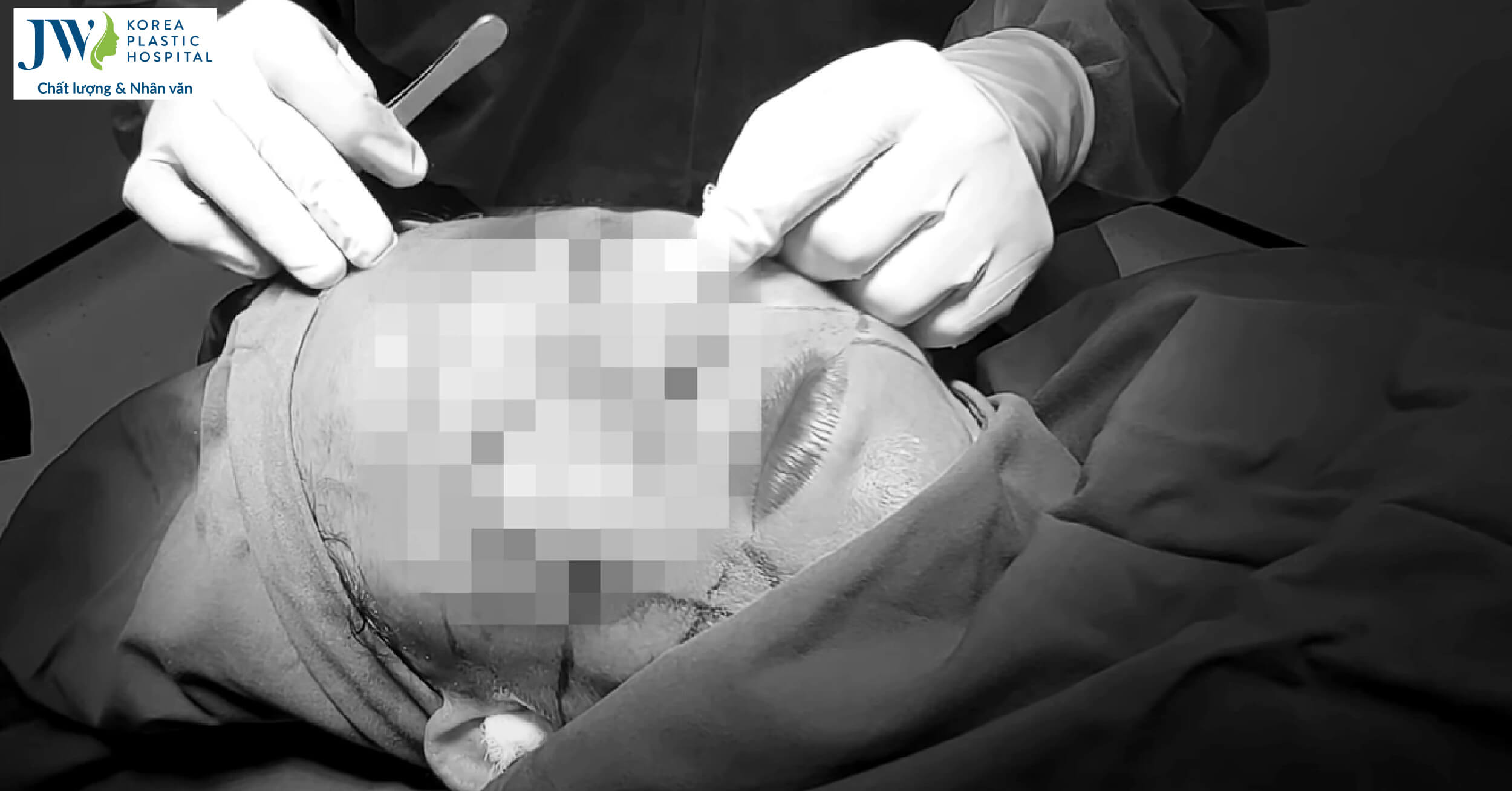 Nữ việt kiều U70 tử vong sau căng da mặt, bác sĩ Tú Dung đưa lời khuyên