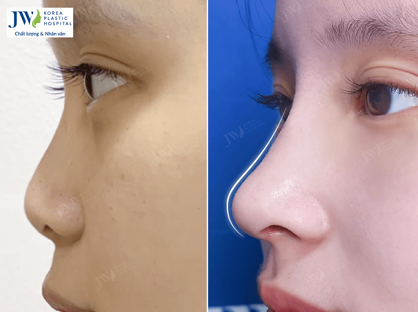 nang-mui-bang-sun-tu-than