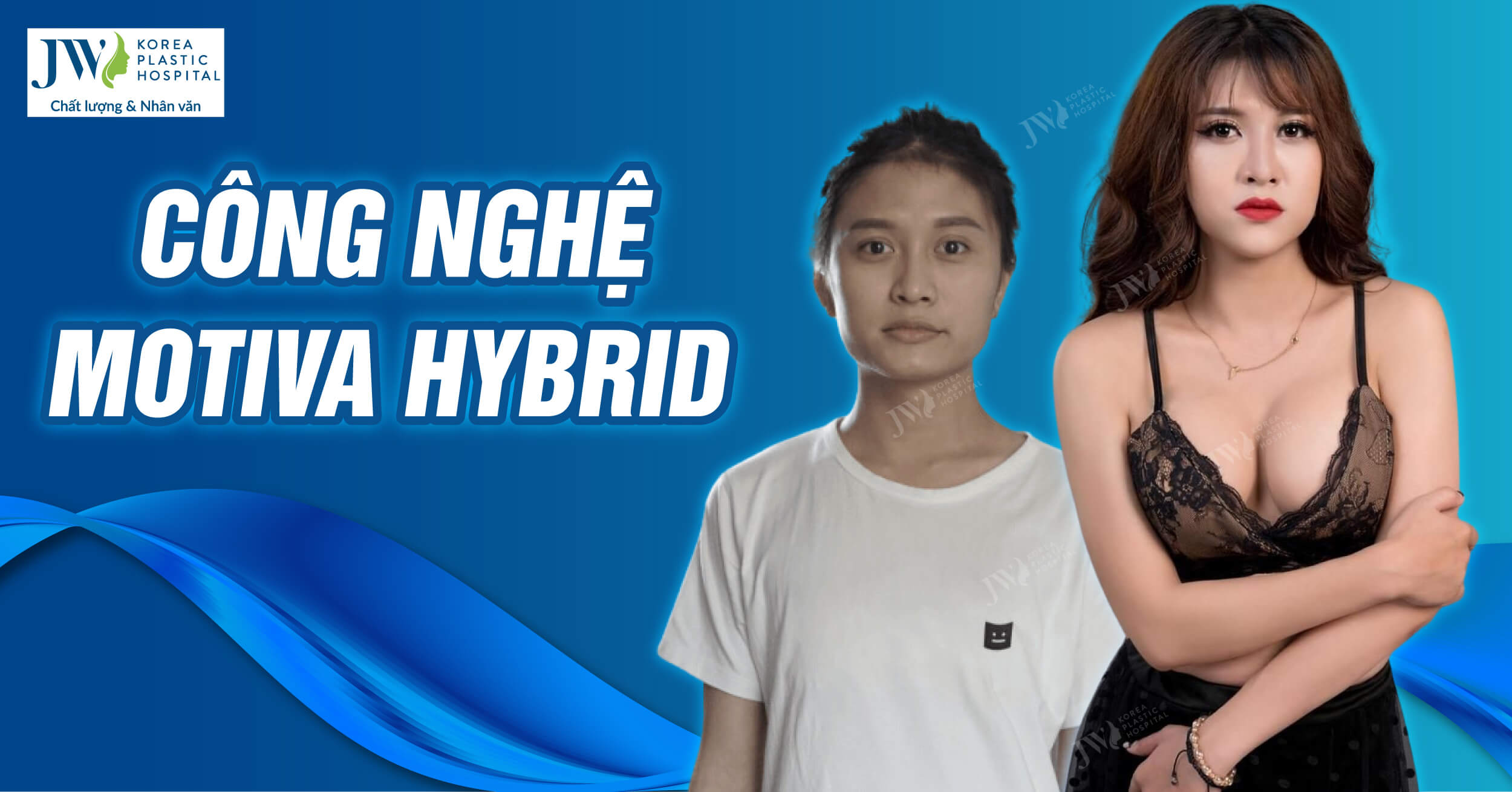 Motiva Hybrid: Xu hướng nâng ngực hiện đại 2024