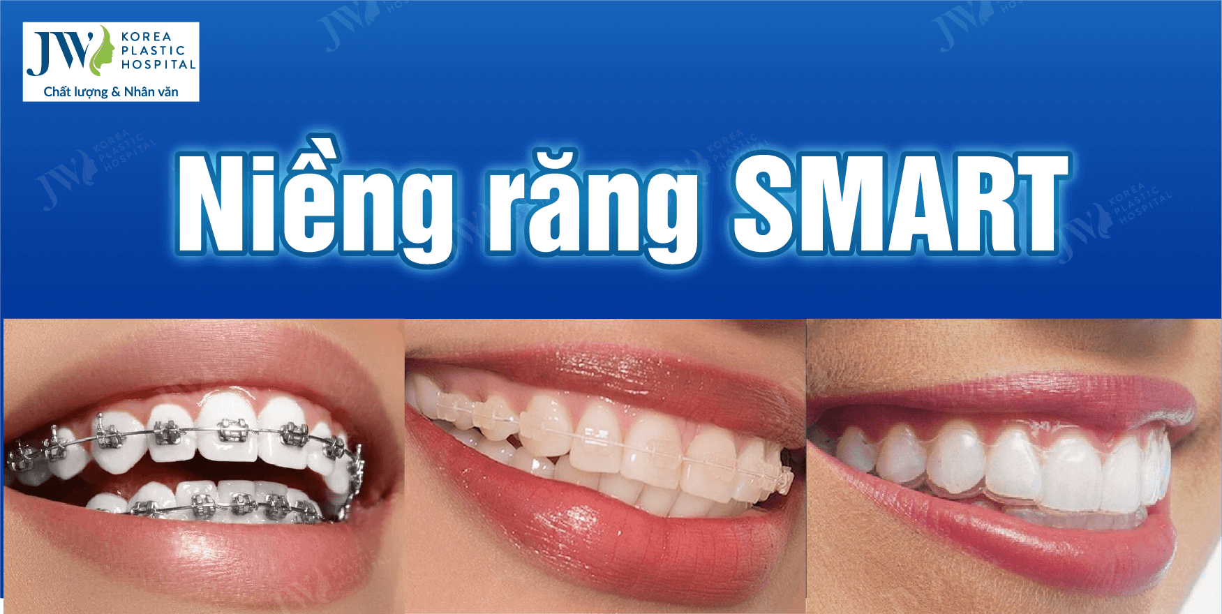 nieng-rang-smart-7