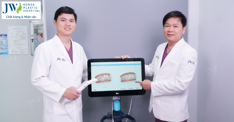 Niềng răng SMART giá bao nhiêu? 