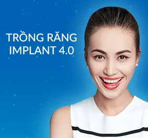 trong-rang-implant-4-0